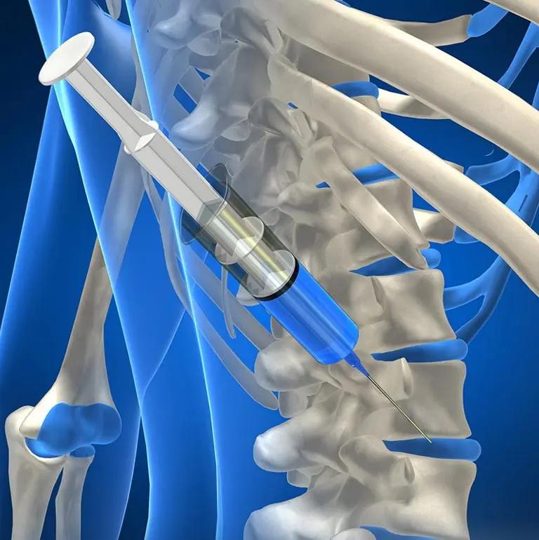 Neurointervention