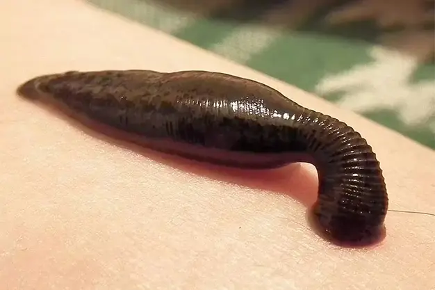 Raktamoksham